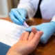 Testing HIV Deutschland